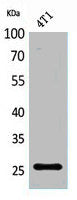 Western Blot analysis of 4T1 cells using CD81 Polyclonal Antibody.
