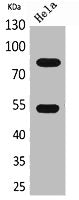 Western Blot analysis of HeLa cells using IFN-γRα Polyclonal Antibody.