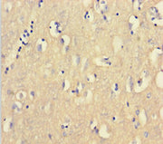 Immunohistochemistry of paraffin-embedded human brain tissue using CSB-PA005637HA01HU at dilution of 1:100