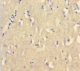 Immunohistochemistry of paraffin-embedded human brain tissue using CSB-PA005637HA01HU at dilution of 1:100