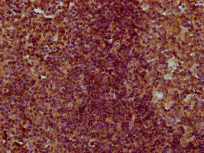 IHC image of CSB-PA005641LA01HU diluted at 1:300 and staining in paraffin-embedded human tonsil tissue performed on a Leica BondTM system. After dewaxing and hydration, antigen retrieval was mediated by high pressure in a citrate buffer (pH 6.0)....