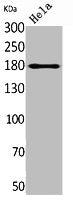 Western Blot analysis of HeLa cells using Endo180 Polyclonal Antibody.