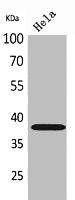 Western Blot analysis of HeLa cells using CD158b2/j Polyclonal Antibody.