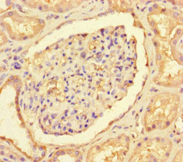 Immunohistochemistry of paraffin-embedded human kidney tissue using CSB-PA005663LA01HU at dilution of 1:100