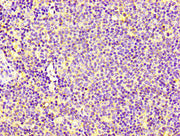 IHC image of CSB-PA005666LA01HU diluted at 1:100 and staining in paraffin-embedded human lymph node tissue performed on a Leica BondTM system. After dewaxing and hydration, antigen retrieval was mediated by high pressure in a citrate buffer (pH 6....