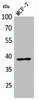 Western Blot analysis of MCF-7 cells using Cerberus Polyclonal Antibody.