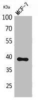 Western Blot analysis of MCF-7 cells using Nov Polyclonal Antibody.