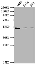 Western Blot Positive WB detected in: A549 whole cell lysate, Hela whole cell lysate, 293 whole cell lysate All lanes: CNR1 antibody at 1:2000 Secondary Goat polyclonal to rabbit IgG at 1/50000 dilution Predicted band size: 53, 46, 50 kDa Observed...