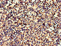 Immunohistochemistry of paraffin-embedded human spleen tissue using CSB-PA005679LA01HU at dilution of 1:100