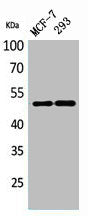 Western Blot analysis of MCF-7, 293 cells using PD-ECGF Polyclonal Antibody.