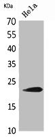 Western Blot analysis of HeLa cells using IFN- Polyclonal Antibody.