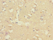 Immunohistochemistry of paraffin-embedded human brain tissue using CSB-PA005692ESR1HU at dilution of 1:100