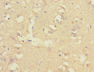 Immunohistochemistry of paraffin-embedded human brain tissue using CSB-PA005692ESR1HU at dilution of 1:100