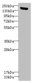Western blot All lanes: CNTNAP1antibody IgG at 1.36ug/ml + Mouse brain tissue Secondary Goat polyclonal to rabbit IgG at 1/10000 dilution Predicted band size: 156 kDa Observed band size: 156 kDa