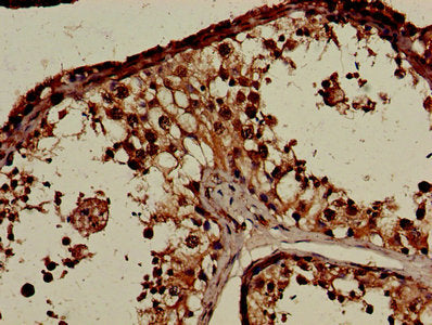 Immunohistochemistry of paraffin-embedded human testis tissue using CSB-PA005692LA01HU at dilution of 1:100