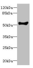 Western blot All lanes: COCH antibody at 1.73µg/ml + Human placenta tissue Secondary Goat polyclonal to rabbit IgG at 1/10000 dilution Predicted band size: 60, 54 kDa Observed band size: 54 kDa