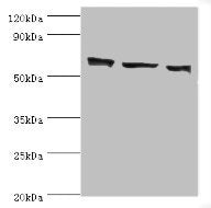 Western blot All lanes: COIL antibody at 3ug/ml Lane 1: MCF-7 whole cell lysate Lane 2: Hela whole cell lysate Lane 3: HepG2 whole cell lysate Secondary Goat polyclonal to rabbit IgG at 1/10000 dilution Predicted band size: 63 kDa Observed band si...