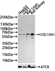 Western blot All lanes: COL10A1 antibody at 4µg/ml + K562 whole cell lysate Secondary Goat polyclonal to rabbit IgG at 1/10000 dilution Predicted band size: 66 kDa Observed band size: 66 kDa