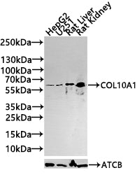Western blot All lanes: COL10A1 antibody at 4µg/ml + K562 whole cell lysate Secondary Goat polyclonal to rabbit IgG at 1/10000 dilution Predicted band size: 66 kDa Observed band size: 66 kDa