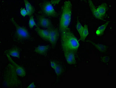 Immunofluorescence staining of U251 cells with CSB-PA005727OA01HU at 1:100, counter-stained with DAPI. The cells were fixed in 4% formaldehyde, permeabilized using 0.2% Triton X-100 and blocked in 10% normal Goat Serum. The cells were then incubat...