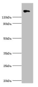 Western blot All lanes: Collagen alpha-1 (II) chain antibody at 10ug/ml + 293T whole cell lysate Secondary Goat polyclonal to rabbit IgG at 1/10000 dilution Predicted band size: 142, 135, 30 kDa Observed band size: 142 kDa