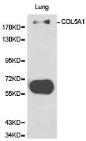 Western blot analysis of extracts of Lung cell line, using COL5A1 antibody.