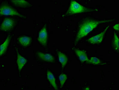 Immunofluorescence staining of U251 cells with CSB-PA005751OA01HU at 1:133, counter-stained with DAPI. The cells were fixed in 4% formaldehyde, permeabilized using 0.2% Triton X-100 and blocked in 10% normal Goat Serum. The cells were then incubat...