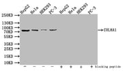 Western Blot Positive WB detected in: HepG2 whole cell lysate, Hela whole cell lysate, HEK293 whole cell lysate, PC-3 whole cell lysate All lanes: COL8A1 antibody at 1:1000 Secondary Goat polyclonal to rabbit IgG at 1/50000 dilution Predicted band...