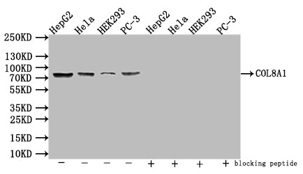 Western Blot Positive WB detected in: HepG2 whole cell lysate, Hela whole cell lysate, HEK293 whole cell lysate, PC-3 whole cell lysate All lanes: COL8A1 antibody at 1:1000 Secondary Goat polyclonal to rabbit IgG at 1/50000 dilution Predicted band...
