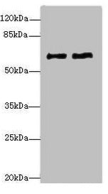Western blot All lanes: COL9A3antibody at 1.36ug/ml Lane 1: MCF-7 whole cell lysate Lane 2: A549 whole cell lysate Secondary Goat polyclonal to rabbit IgG at 1/10000 dilution Predicted band size: 64 kDa Observed band size: 64 kDa