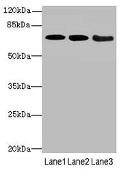 Western blot All lanes: COL9A3antibody at 3.66ug/ml Lane 1: K562 whole cell lysate Lane 2: MCF-7 whole cell lysate Lane 3: A549 whole cell lysate Secondary Goat polyclonal to rabbit IgG at 1/10000 dilution Predicted band size: 64 kDa Observed band...