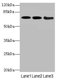 Western blot All lanes: COL9A3antibody at 3.66ug/ml Lane 1: K562 whole cell lysate Lane 2: MCF-7 whole cell lysate Lane 3: A549 whole cell lysate Secondary Goat polyclonal to rabbit IgG at 1/10000 dilution Predicted band size: 64 kDa Observed band...
