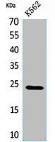 Western Blot analysis of K562 cells using CyPB Polyclonal Antibody.