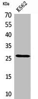 Western Blot analysis of K562 cells using FGF-8 Polyclonal Antibody.