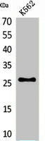 Western Blot analysis of K562 cells using FGF-16 Polyclonal Antibody.