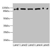 Western blot All lanes: COPB1 antibody at 1µg/ml Lane 1: Hela whole cell lysate Lane 2: Jurkat whole cell lysate Lane 3: NIH/3T3 whole cell lysate Lane 4: Mouse liver tissue Lane 5: A549 whole cell lysate Secondary Goat polyclonal to rabbit IgG at...