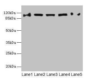 Western blot All lanes: COPB1 antibody at 1µg/ml Lane 1: Hela whole cell lysate Lane 2: Jurkat whole cell lysate Lane 3: NIH/3T3 whole cell lysate Lane 4: Mouse liver tissue Lane 5: A549 whole cell lysate Secondary Goat polyclonal to rabbit IgG at...