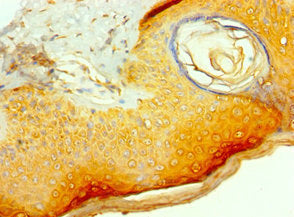 Immunohistochemistry of paraffin-embedded human skin tissue using CSB-PA005789ESR2HU at dilution of 1:100
