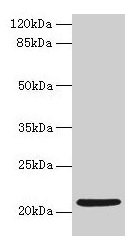 Western blot All lanes: COPZ1 antibody at 1µg/ml + K562 whole cell lysate Secondary Goat polyclonal to rabbit IgG at 1/10000 dilution Predicted band size: 21, 15, 18, 22, 19 kDa Observed band size: 21 kDa