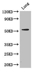 Western Blot Positive WB detected in: Mouse lung tissue All lanes: CORO1A antibody at 2.7ug/ml Secondary Goat polyclonal to rabbit IgG at 1/50000 dilution Predicted band size: 52 kDa Observed band size: 52 kDa