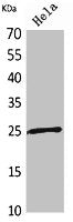 Western Blot analysis of HeLa cells using PRX I Polyclonal Antibody.