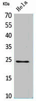 Western Blot analysis of HeLa cells using Rab 5A Polyclonal Antibody.