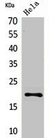 Western Blot analysis of HeLa cells using CD3-δ Polyclonal Antibody.