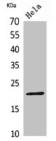 Western Blot analysis of HeLa cells using CD3-ε Polyclonal Antibody.