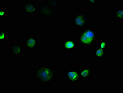 Immunofluorescence staining of MCF-7 cells with CSB-PA005835LA01HU at 1:133, counter-stained with DAPI. The cells were fixed in 4% formaldehyde, permeabilized using 0.2% Triton X-100 and blocked in 10% normal Goat Serum. The cells were then incuba...
