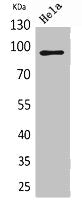 Western Blot analysis of HeLa cells using Integrin β2 Polyclonal Antibody.