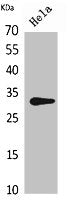 Western Blot analysis of HeLa cells using CD37 Polyclonal Antibody.