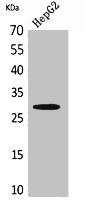 Western Blot analysis of HepG2 cells using CD69 Polyclonal Antibody.