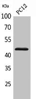 Western Blot analysis of PC12 cells using IL-1RII Polyclonal Antibody.