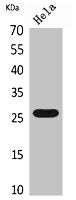 Western Blot analysis of HeLa cells using DCL-1 Polyclonal Antibody.